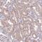 Cyclin D2 antibody, NBP2-14460, Novus Biologicals, Immunohistochemistry frozen image 