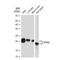 Serine And Arginine Rich Splicing Factor 3 antibody, GTX03224, GeneTex, Western Blot image 