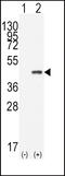 Caudal Type Homeobox 2 antibody, MBS9201191, MyBioSource, Western Blot image 