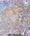 Serpin Family H Member 1 antibody, abx025194, Abbexa, Immunohistochemistry paraffin image 