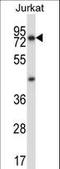 Mucolipin 1 antibody, LS-C164098, Lifespan Biosciences, Western Blot image 