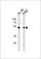 Myocyte Enhancer Factor 2C antibody, PA5-13287, Invitrogen Antibodies, Western Blot image 