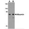 ALB antibody, TA306776, Origene, Western Blot image 