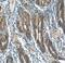 Fibroblast growth factor 5 antibody, FNab03094, FineTest, Immunohistochemistry paraffin image 