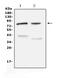 Choline O-Acetyltransferase antibody, A01192-3, Boster Biological Technology, Western Blot image 