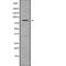 Nephrocystin 1 antibody, abx217218, Abbexa, Western Blot image 