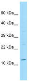 INSSA1 antibody, TA338321, Origene, Western Blot image 