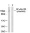 Nuclear Factor Kappa B Subunit 2 antibody, PA5-37664, Invitrogen Antibodies, Western Blot image 