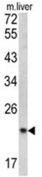 Signal Peptidase Complex Subunit 3 antibody, AP17761PU-N, Origene, Western Blot image 