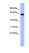 Kelch Like Family Member 8 antibody, NBP1-80346, Novus Biologicals, Western Blot image 