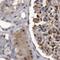 RAD23 Homolog B, Nucleotide Excision Repair Protein antibody, NBP1-89698, Novus Biologicals, Immunohistochemistry paraffin image 