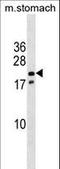 NK3 Homeobox 1 antibody, LS-C158233, Lifespan Biosciences, Western Blot image 