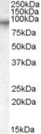 Coagulation Factor XIII A Chain antibody, PA5-18806, Invitrogen Antibodies, Western Blot image 