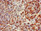 Ring Finger Protein 126 antibody, CSB-PA019828LA01HU, Cusabio, Immunohistochemistry paraffin image 