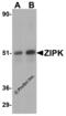 Death Associated Protein Kinase 3 antibody, 2067, ProSci, Western Blot image 