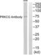 Protein Kinase C Gamma antibody, abx015169, Abbexa, Western Blot image 