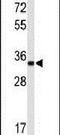 ATPase Na+/K+ Transporting Subunit Beta 2 antibody, PA5-26279, Invitrogen Antibodies, Western Blot image 