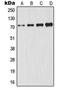 Glutamate-Cysteine Ligase Catalytic Subunit antibody, LS-C352255, Lifespan Biosciences, Western Blot image 