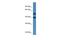 Nucleoporin 37 antibody, A11877, Boster Biological Technology, Western Blot image 