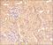 Thioredoxin Interacting Protein antibody, NBP1-54578, Novus Biologicals, Immunohistochemistry paraffin image 