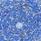 TNF Receptor Superfamily Member 1A antibody, GTX33550, GeneTex, Immunohistochemistry paraffin image 