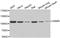 Oncostatin M Receptor antibody, A6681, ABclonal Technology, Western Blot image 