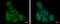 OCRL Inositol Polyphosphate-5-Phosphatase antibody, GTX103107, GeneTex, Immunocytochemistry image 