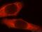 GTPase, IMAP Family Member 7 antibody, 17293-1-AP, Proteintech Group, Immunofluorescence image 