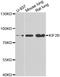 Kinesin Family Member 2B antibody, A6480, ABclonal Technology, Western Blot image 