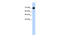 CXXC Finger Protein 1 antibody, 29-009, ProSci, Western Blot image 