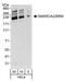 SWI/SNF Related, Matrix Associated, Actin Dependent Regulator Of Chromatin, Subfamily A, Member 2 antibody, A301-014A, Bethyl Labs, Western Blot image 