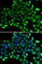 Copper Metabolism Domain Containing 1 antibody, STJ29229, St John