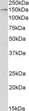 Histone Deacetylase 6 antibody, LS-B11166, Lifespan Biosciences, Western Blot image 