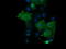 Parvin Alpha antibody, LS-C787968, Lifespan Biosciences, Immunofluorescence image 