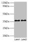 SPT3 Homolog, SAGA And STAGA Complex Component antibody, CSB-PA022956LA01HU, Cusabio, Western Blot image 