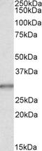 Carbonic Anhydrase 1 antibody, LS-B3971, Lifespan Biosciences, Western Blot image 