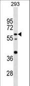 CCR4-NOT Transcription Complex Subunit 4 antibody, LS-C168889, Lifespan Biosciences, Western Blot image 