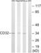 Low affinity immunoglobulin gamma Fc region receptor II-b antibody, A01690-1, Boster Biological Technology, Western Blot image 