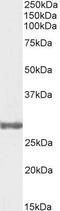 Catechol-O-Methyltransferase antibody, GTX89277, GeneTex, Western Blot image 