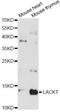 Lacritin antibody, LS-C749629, Lifespan Biosciences, Western Blot image 