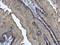 Keratin 17 antibody, GTX103765, GeneTex, Immunohistochemistry paraffin image 