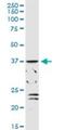 Alcohol Dehydrogenase 1C (Class I), Gamma Polypeptide antibody, H00000126-D01P, Novus Biologicals, Western Blot image 