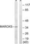 Myristoylated Alanine Rich Protein Kinase C Substrate antibody, LS-C118173, Lifespan Biosciences, Western Blot image 