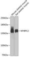 Myosin Binding Protein C, Fast Type antibody, A14099-2, Boster Biological Technology, Western Blot image 
