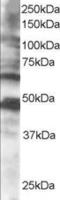 Cytoplasmic Polyadenylation Element Binding Protein 1 antibody, LS-C54677, Lifespan Biosciences, Western Blot image 