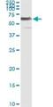 Phosphoglycerate Dehydrogenase antibody, H00026227-M01, Novus Biologicals, Immunoprecipitation image 