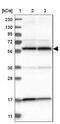 Protein Phosphatase 3 Catalytic Subunit Gamma antibody, NBP1-86656, Novus Biologicals, Western Blot image 