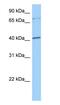 SRY-Box 4 antibody, ab80261, Abcam, Western Blot image 