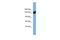 Aminoadipate-Semialdehyde Dehydrogenase antibody, PA5-69954, Invitrogen Antibodies, Western Blot image 