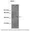 Inhibitor Of Nuclear Factor Kappa B Kinase Regulatory Subunit Gamma antibody, 27-263, ProSci, Enzyme Linked Immunosorbent Assay image 